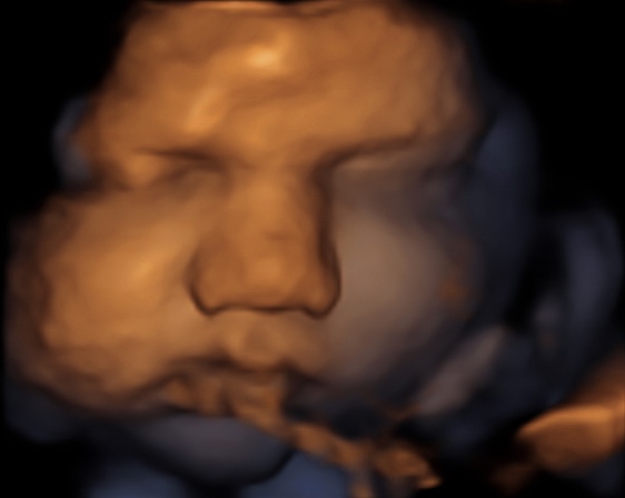 Een foto van de baby.