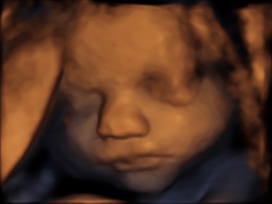 Een echo na 30 weken.